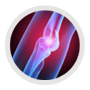 Elbow Injuries, Tennis Elbow