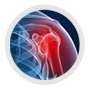 Shoulder Injuries, Post Surgical Rehabilitation